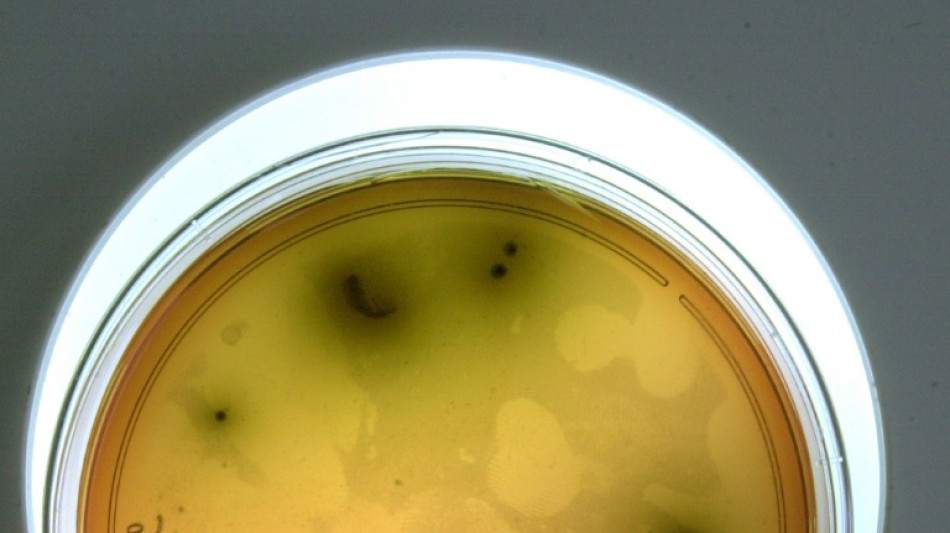 List&eacute;riose: 12 cas, dont 2 mortels, en lien avec des charcuteries d'une entreprise de la Dr&ocirc;me