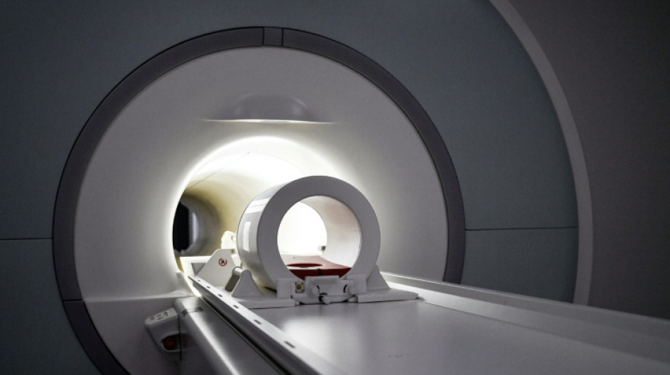 Una nueva herramienta de IA ayuda a localizar lesiones en niños epilépticos