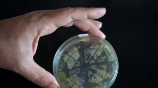 Ci&ecirc;ncia argentina 'est&aacute; &agrave; beira do colapso' devido aos cortes de financiamento de Milei