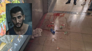 Ragazza sfregiata a Milano, 'ho pensato di morire'