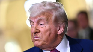 Trump, diagnosticado con insuficiencia venosa crónica tras hinchazón en las piernas