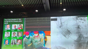 Chirurghi di Padova operano in diretta streaming al congresso di New York