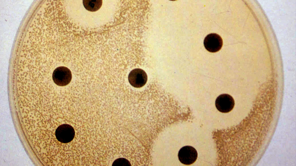 Epilessia resistente a farmaci, da batteri intestinali strategia per rallentarla