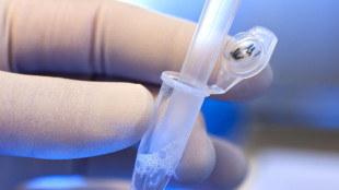 Maculopatia senile, positivi i primi dati sulla terapia genica