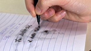 Sudare troppo, un disturbo che colpisce fino al 3% bambini e adolescenti
