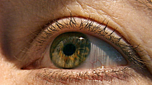 Rauchen sch&auml;digt nicht nur Herz und Lunge - sondern auch die Augen